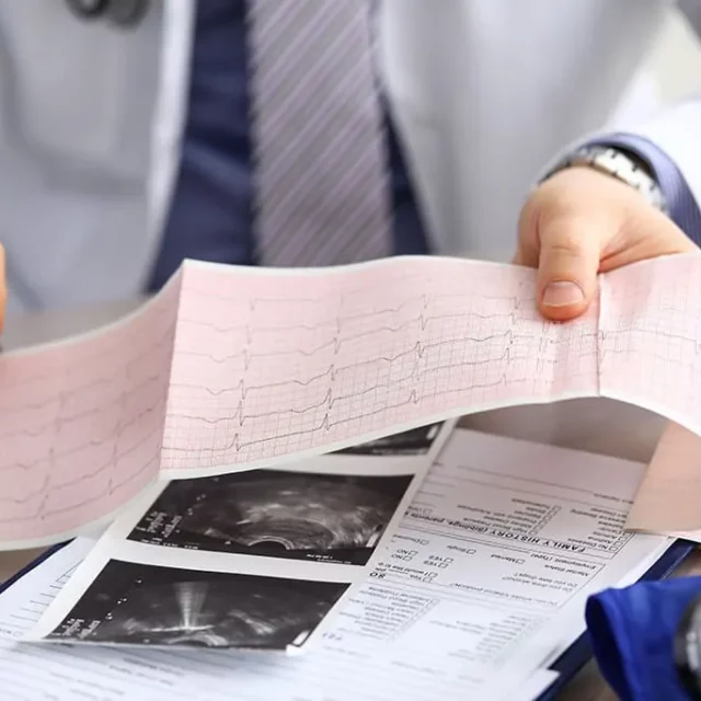 kardiografima-ilektrokardiografima-eopy-geniki-kliniki-west-athens-peristeri-westathensclinic.jpg